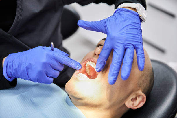 Best Emergency Broken Tooth Repair in Berlin, WI